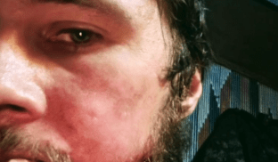 Захисникам, які вже не можуть оборонятися, обіцяють допомогти з боєкомплектом та припасами Дорога в Авдіївку всіяна нашими трупами