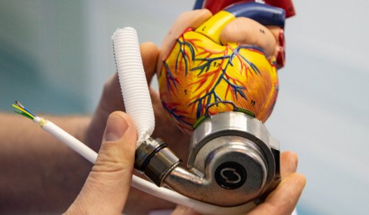В Украине впервые в городской больнице провели операцию по имплантации механического сердца