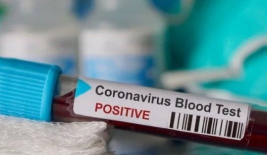 В Славянске коронавирус обнаружили сразу у нескольких детей