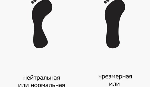 Пронация: как положение стопы влияет на выбор обуви?
